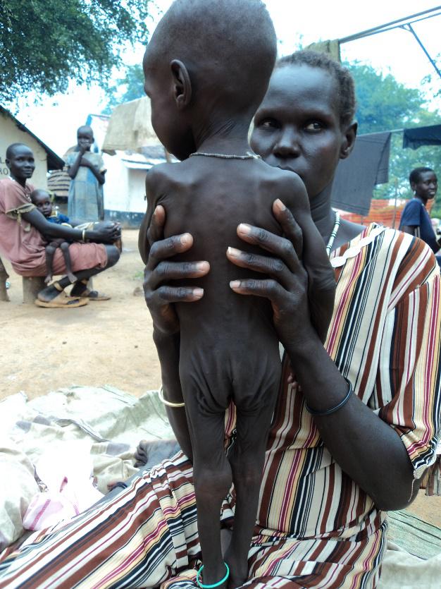 Caring for South Sudan children-Comitato Mahmud