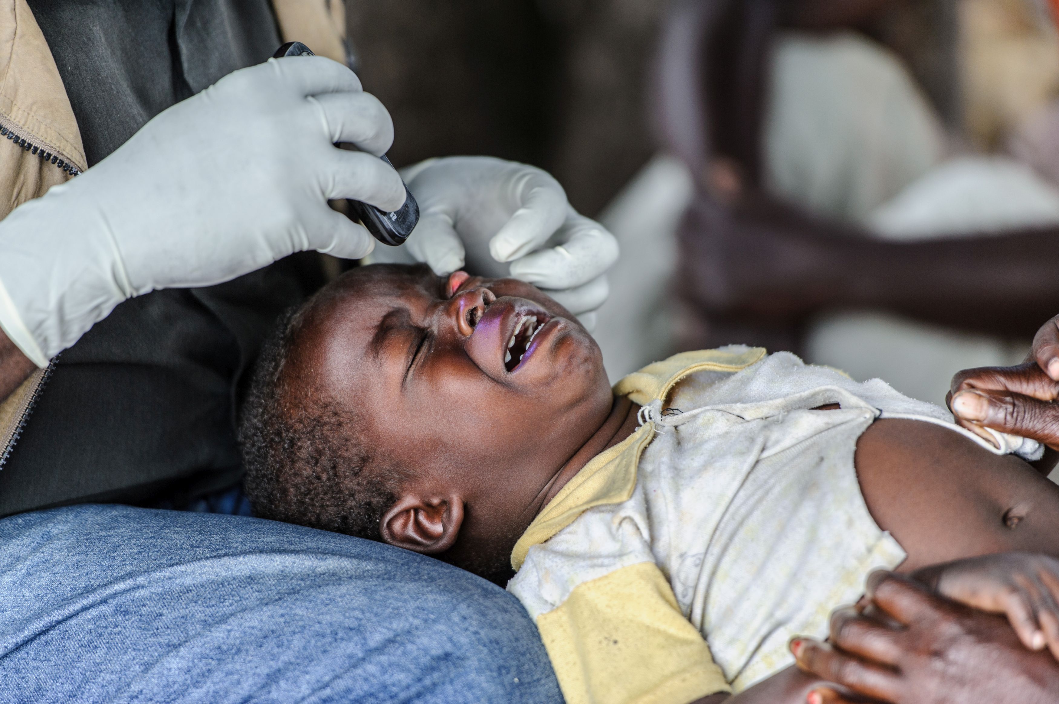 Fermare il tracoma per sempre si può!-Sightsavers Italia Onlus